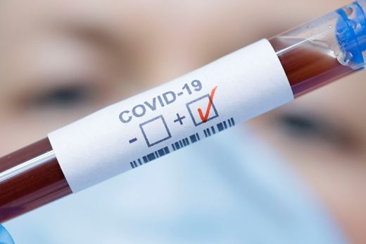 Kevesebb az új fertőzött. Szatmár megyében mindössze 8 az elmúlt 24 órában