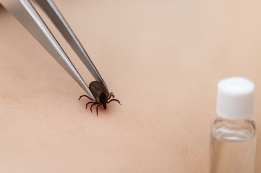 Tavaszi kirándulás, majális? A kullancsokra figyelmeztet a Szatmár Megyei Sürgősségi Kórház
